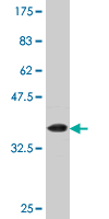 1 - NSD1 Antibody (monoclonal) (M08) AT3117a