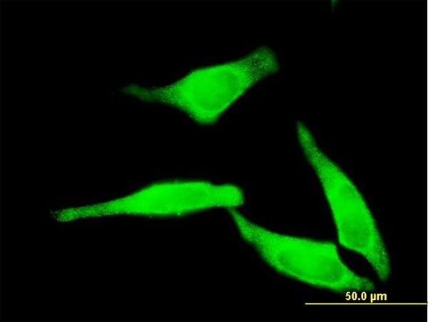 3 - NT5C2 Antibody (monoclonal) (M02) AT3120a