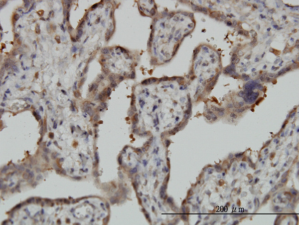 2 - NT5C2 Antibody (monoclonal) (M02) AT3120a