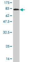 1 - NT5C2 Antibody (monoclonal) (M02) AT3120a