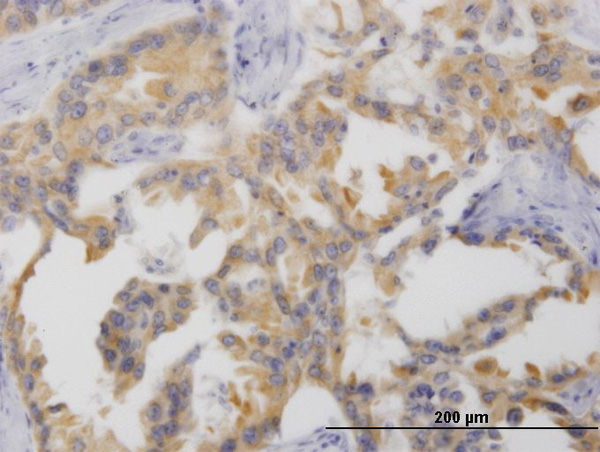 2 - NTNG2 Antibody (monoclonal) (M01) AT3121a