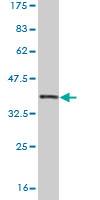 1 - NTNG2 Antibody (monoclonal) (M01) AT3121a