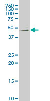 1 - NTNG2 Antibody (monoclonal) (M01) AT3121a