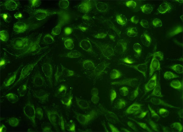 3 - NUCB1 Antibody (monoclonal) (M01) AT3124a