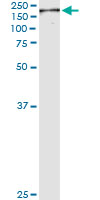 5 - NUMA1 Antibody (monoclonal) (M01) AT3134a