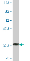 1 - NXF2 Antibody (monoclonal) (M08) AT3140a