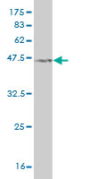 1 - NXT1 Antibody (monoclonal) (M08) AT3141a