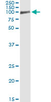 5 - OCLN Antibody (monoclonal) (M01) AT3143a