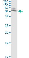 5 - ODC1 Antibody (monoclonal) (M01) AT3145a