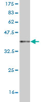 1 - OPHN1 Antibody (monoclonal) (M03) AT3150a
