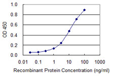 10 - OSBPL8 Antibody (monoclonal) (M02) AT3157a