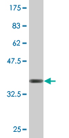 1 - OSBPL8 Antibody (monoclonal) (M02) AT3157a