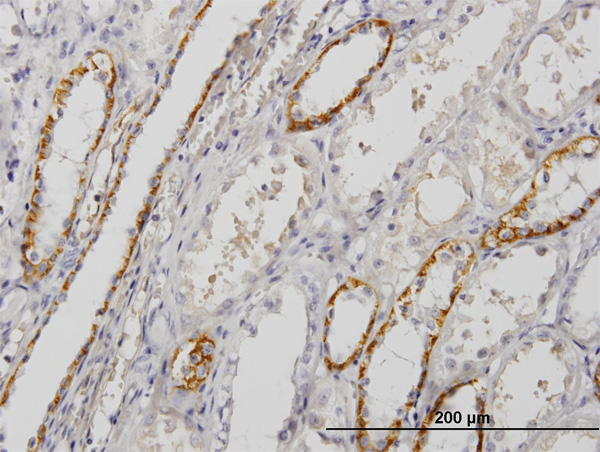 2 - PALM Antibody (monoclonal) (M09) AT3176a