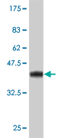 1 - PARC Antibody (monoclonal) (M01) AT3180a