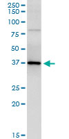 5 - PARVG Antibody (monoclonal) (M01) AT3185a