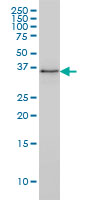 1 - PARVG Antibody (monoclonal) (M01) AT3185a