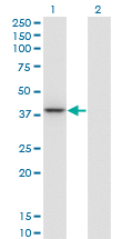 1 - PARVG Antibody (monoclonal) (M01) AT3185a