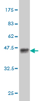1 - PASK Antibody (monoclonal) (M01) AT3188a