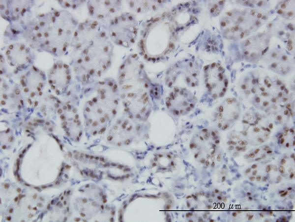 2 - PBX3 Antibody (monoclonal) (M01) AT3202a