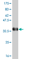 1 - PBX3 Antibody (monoclonal) (M01) AT3202a