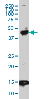 1 - PBX3 Antibody (monoclonal) (M01) AT3202a