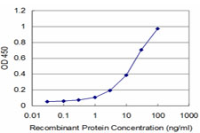 10 - PBX3 Antibody (monoclonal) (M03) AT3203a