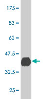 1 - PBX3 Antibody (monoclonal) (M03) AT3203a