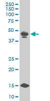 1 - PBX3 Antibody (monoclonal) (M03) AT3203a