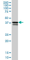 1 - PCBP2 Antibody (monoclonal) (M02) AT3208a