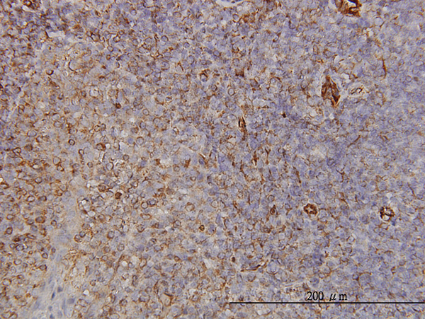 2 - PCDH8 Antibody (monoclonal) (M01) AT3216a
