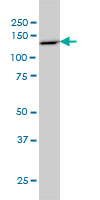 1 - PCDH8 Antibody (monoclonal) (M01) AT3216a