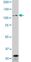 1 - PCDHGA2 Antibody (monoclonal) (M01) AT3227a