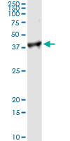 5 - PCNA Antibody (monoclonal) (M02) AT3236a