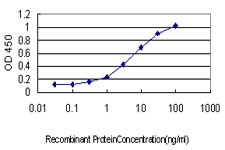 10 - PDCD11 Antibody (monoclonal) (M01) AT3245a