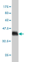 1 - PDE3A Antibody (monoclonal) (M01) AT3254a