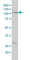 1 - PDE4DIP Antibody (monoclonal) (M01) AT3257a
