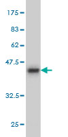 1 - PDE6D Antibody (monoclonal) (M06) AT3258a