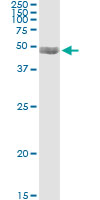 5 - PDLIM7 Antibody (monoclonal) (M01) AT3264a