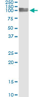 5 - PECAM1 Antibody (monoclonal) (M01) AT3267a