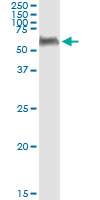 5 - PEPD Antibody (monoclonal) (M01) AT3268a