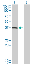1 - PEX10 Antibody (monoclonal) (M01) AT3271a