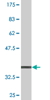 1 - PEX6 Antibody (monoclonal) (M04) AT3272a