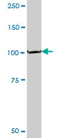 1 - PEX6 Antibody (monoclonal) (M04) AT3272a