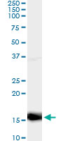 5 - PF4 Antibody (monoclonal) (M01) AT3273a