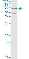 5 - PGM3 Antibody (monoclonal) (M01) AT3284a