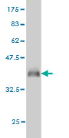 1 - PGRMC2 Antibody (monoclonal) (M04) AT3290a