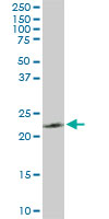 1 - PGRMC2 Antibody (monoclonal) (M04) AT3290a