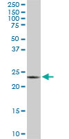 1 - PGRMC2 Antibody (monoclonal) (M04) AT3290a