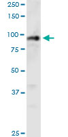 1 - PHC1 Antibody (monoclonal) (M05) AT3293a