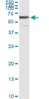 5 - PHGDH Antibody (monoclonal) (M01) AT3299a